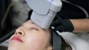 Trẻ hóa da HIFU là gì? Quy trình, hiệu quả và lưu ý chăm sóc