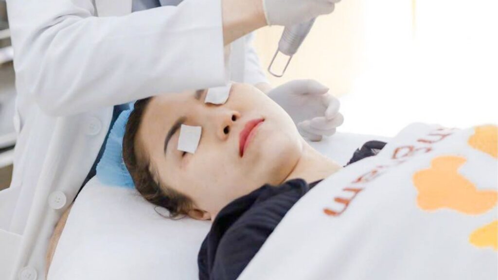 Trị nám bằng laser: Cơ chế, độ hiệu quả và lưu ý quan trọng bạn cần biết