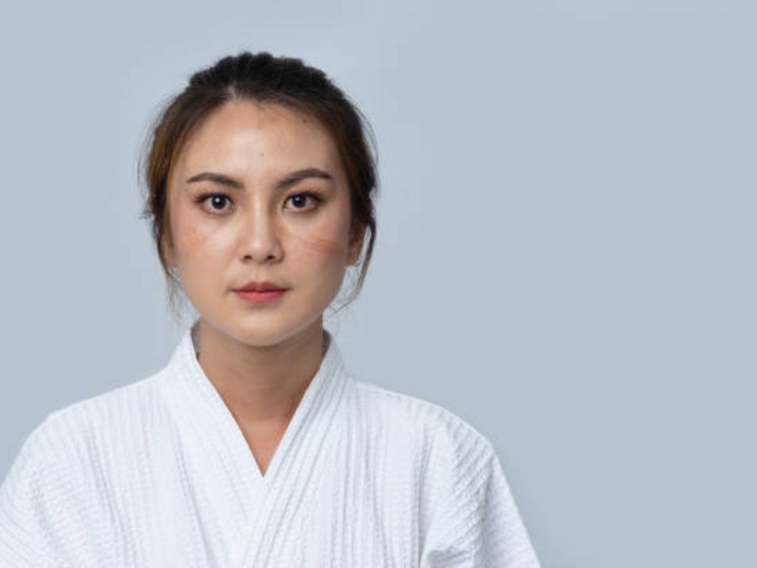 tình trạng nám da chân sâu lâu năm có thể cân nhắc xóa nám bằng laser