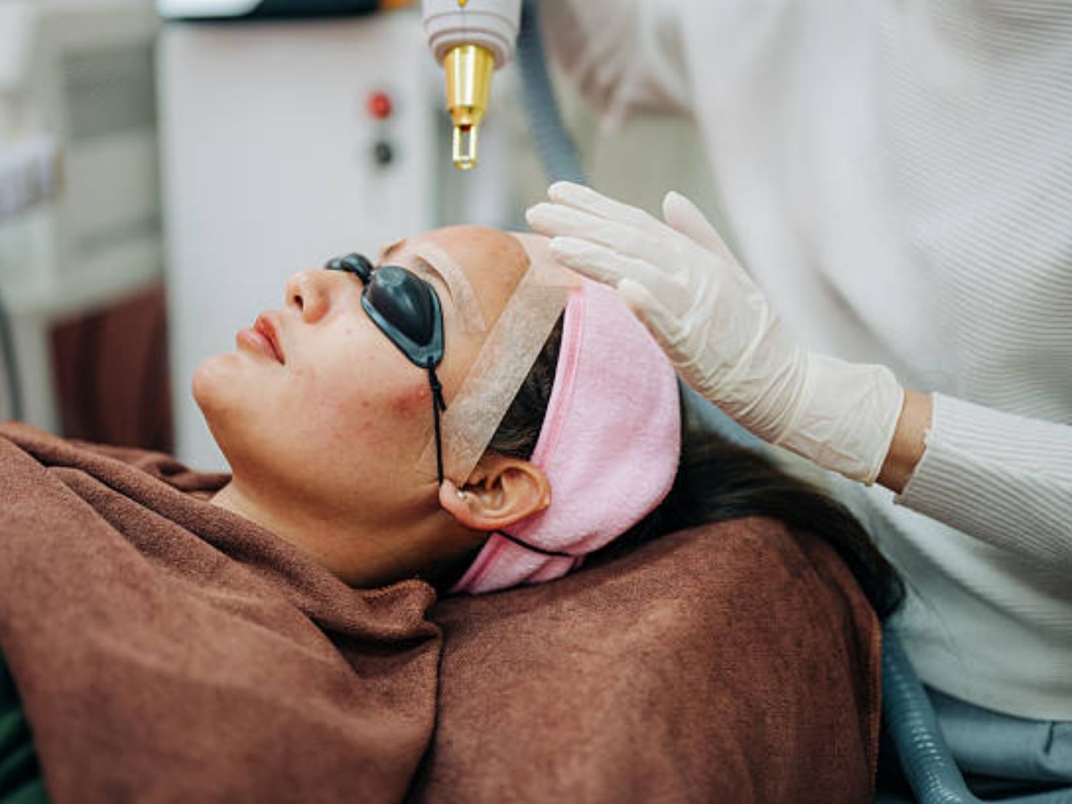 Trị nám bằng laser là phương pháp sử dụng thiết bị phát năng lượng ánh sáng phá vỡ sắc tố đậm màu