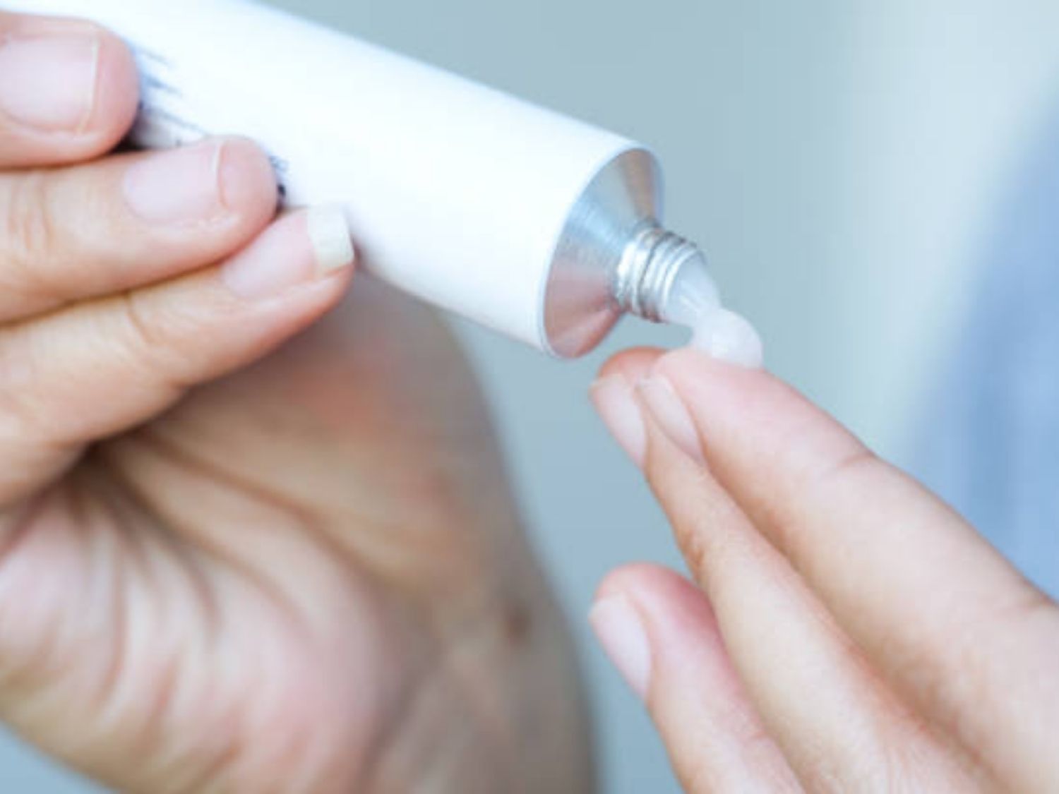 Thuốc bôi và hoạt chất kiểm soát melanin phù hợp nám nhẹ và có hiệu quả hơi chậm
