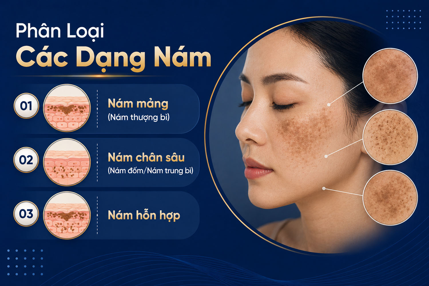 ảnh mô tả Phân Loại Các Dạng Nám Phổ Biến