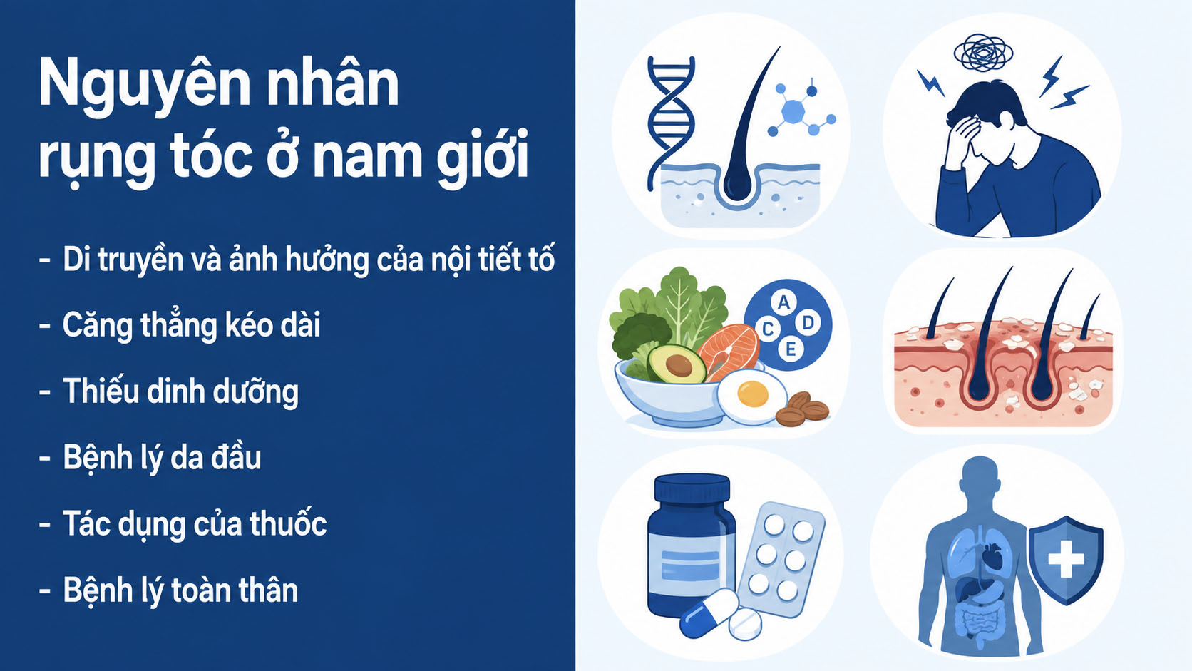 ảnh mô tả chi tiết Nguyên nhân rụng tóc ở nam giới