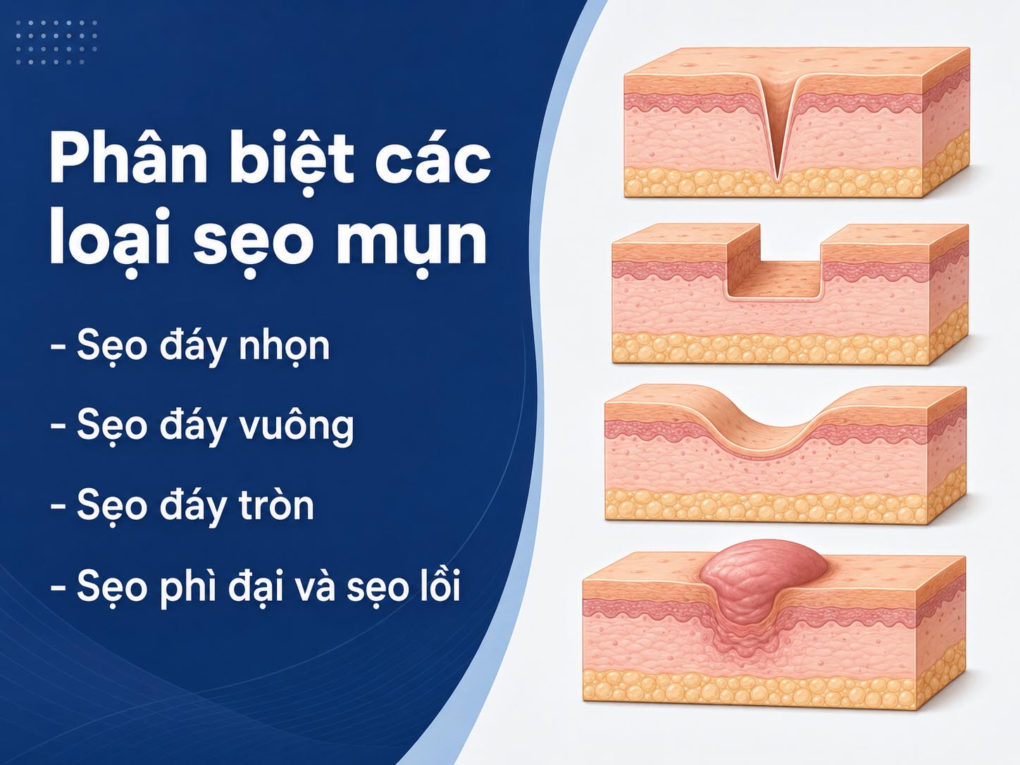 ảnh mô tả phân biệt các loại sẹo mụn