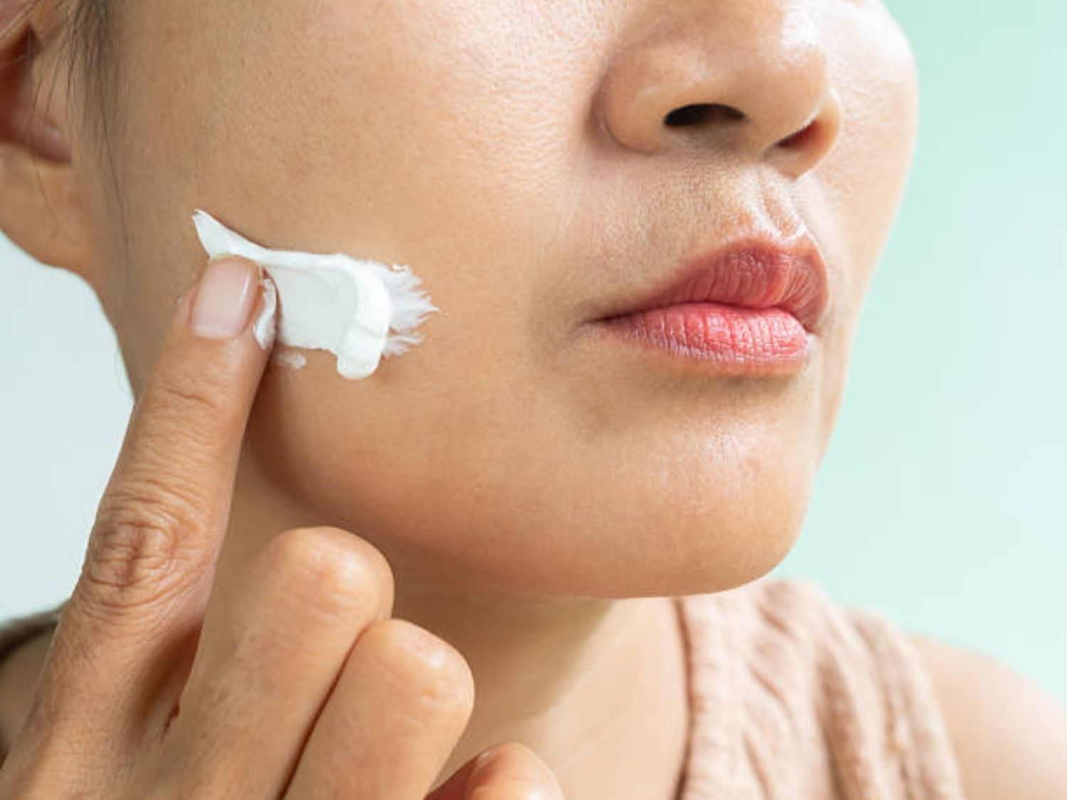 Dưỡng ẩm cho da sau khi điều trị sẹo rỗ là cần thiết