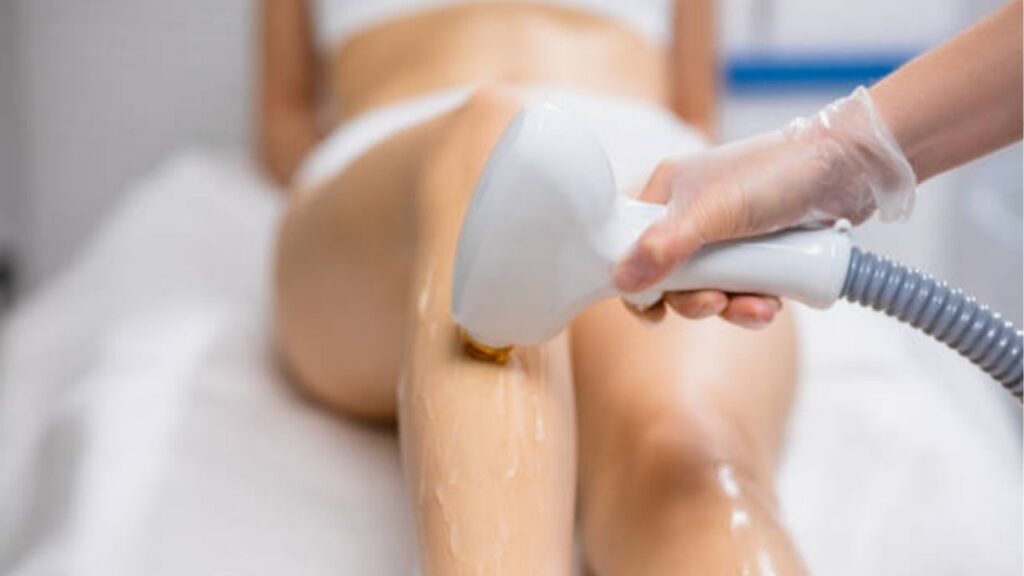 4 Phương pháp triệt lông chân phổ biến: Ưu và nhược điểm từng cách