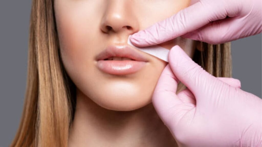 5 Phương pháp triệt lông mép giúp da sạch mịn lâu dài