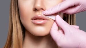 5 Phương pháp triệt lông mép giúp da sạch mịn lâu dài