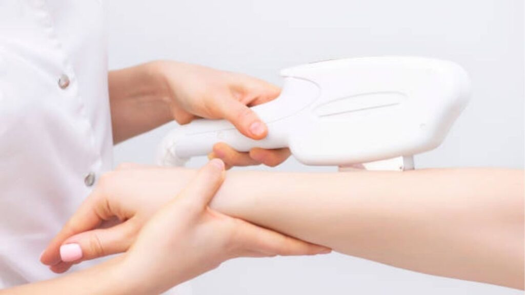 Triệt lông vĩnh viễn là gì? Có mọc lại không và cần bao nhiêu buổi
