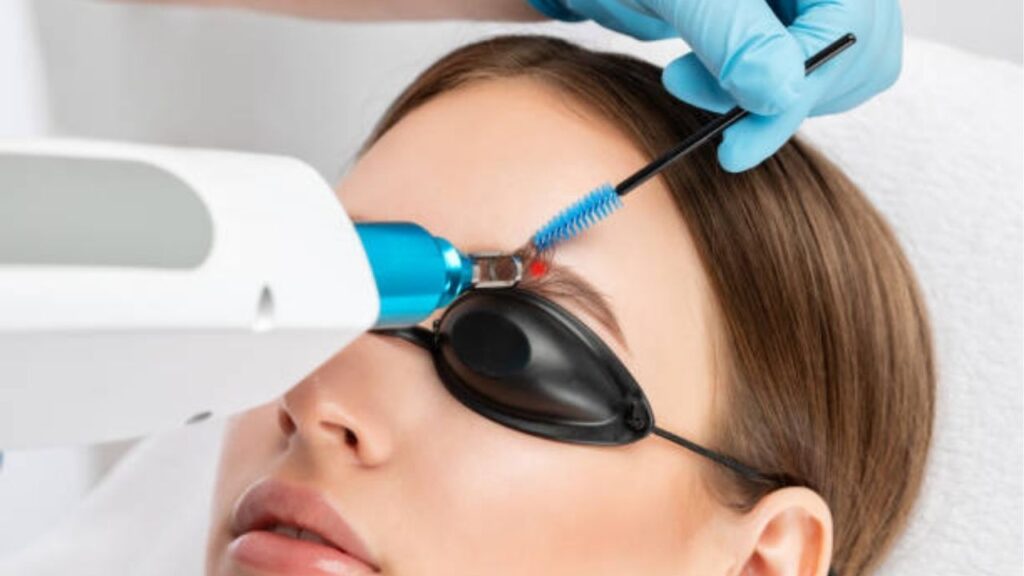 Xóa xăm lông mày: Số buổi, phương pháp và những lưu ý cần biết