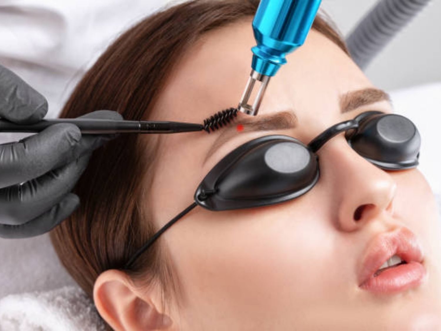 Xóa xăm lông mày bằng laser Nhờ cơ chế quang nhiệt chọn lọc, ánh sáng laser chỉ tác động chính xác vào các tế bào chứa mực xăm