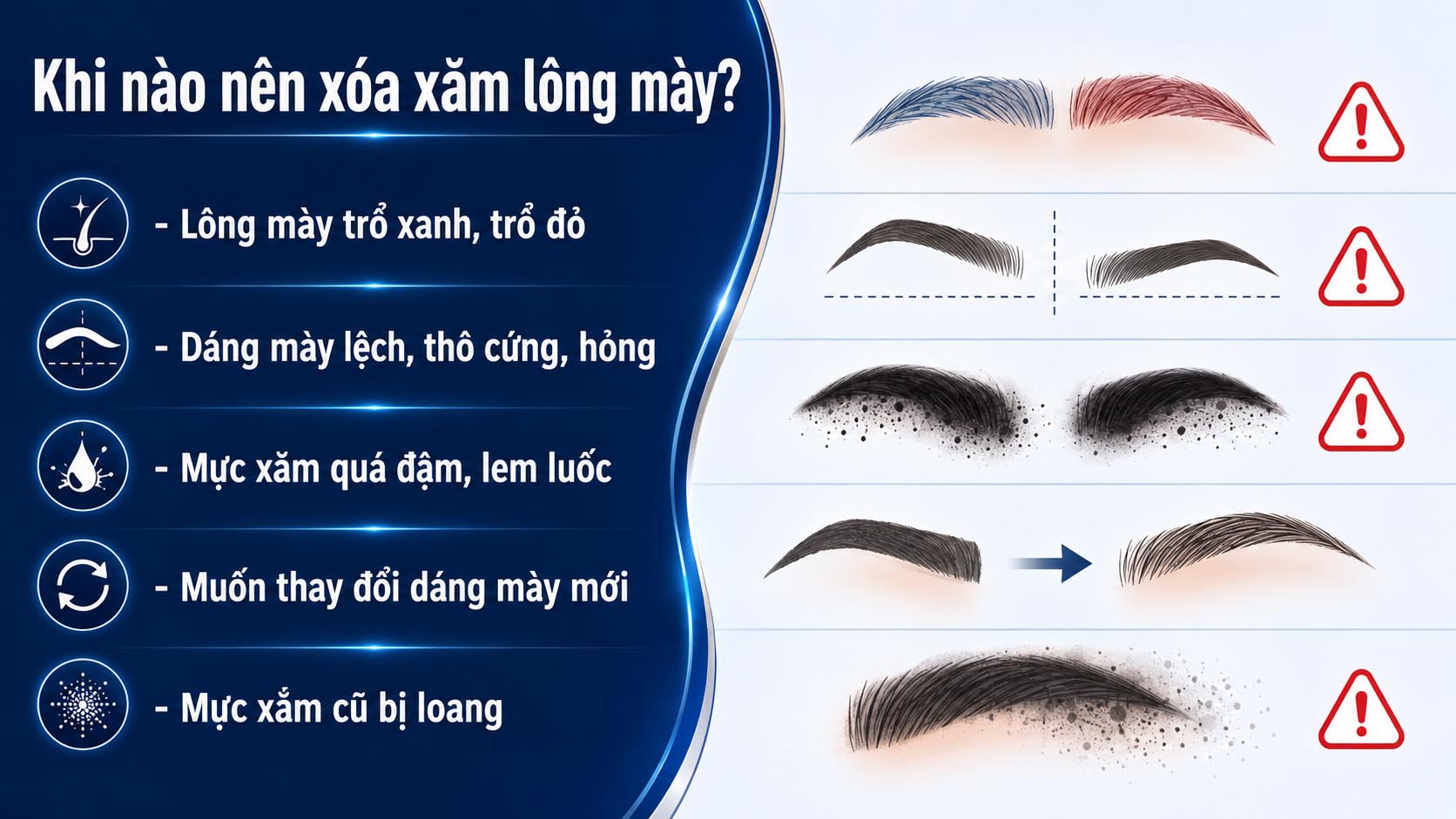 ảnh mô tả các trường hợp nên cân nhắc xóa xăm lông mày