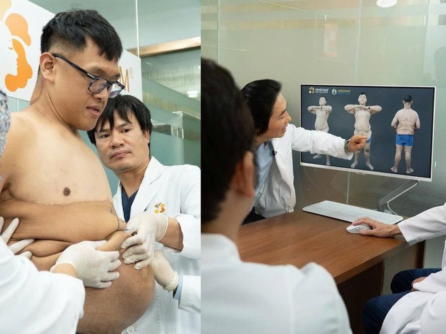 Trọng Nhân bước vào lần phẫu thuật xử lý da thừa đầy thách thức sau giảm cân tại Bệnh viện thẩm mỹ Kangnam