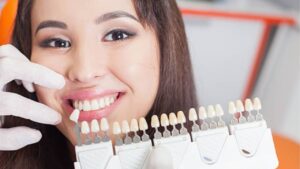 Bọc răng sứ ở đâu tốt? Bác sĩ gợi ý top địa chỉ được đánh giá cao