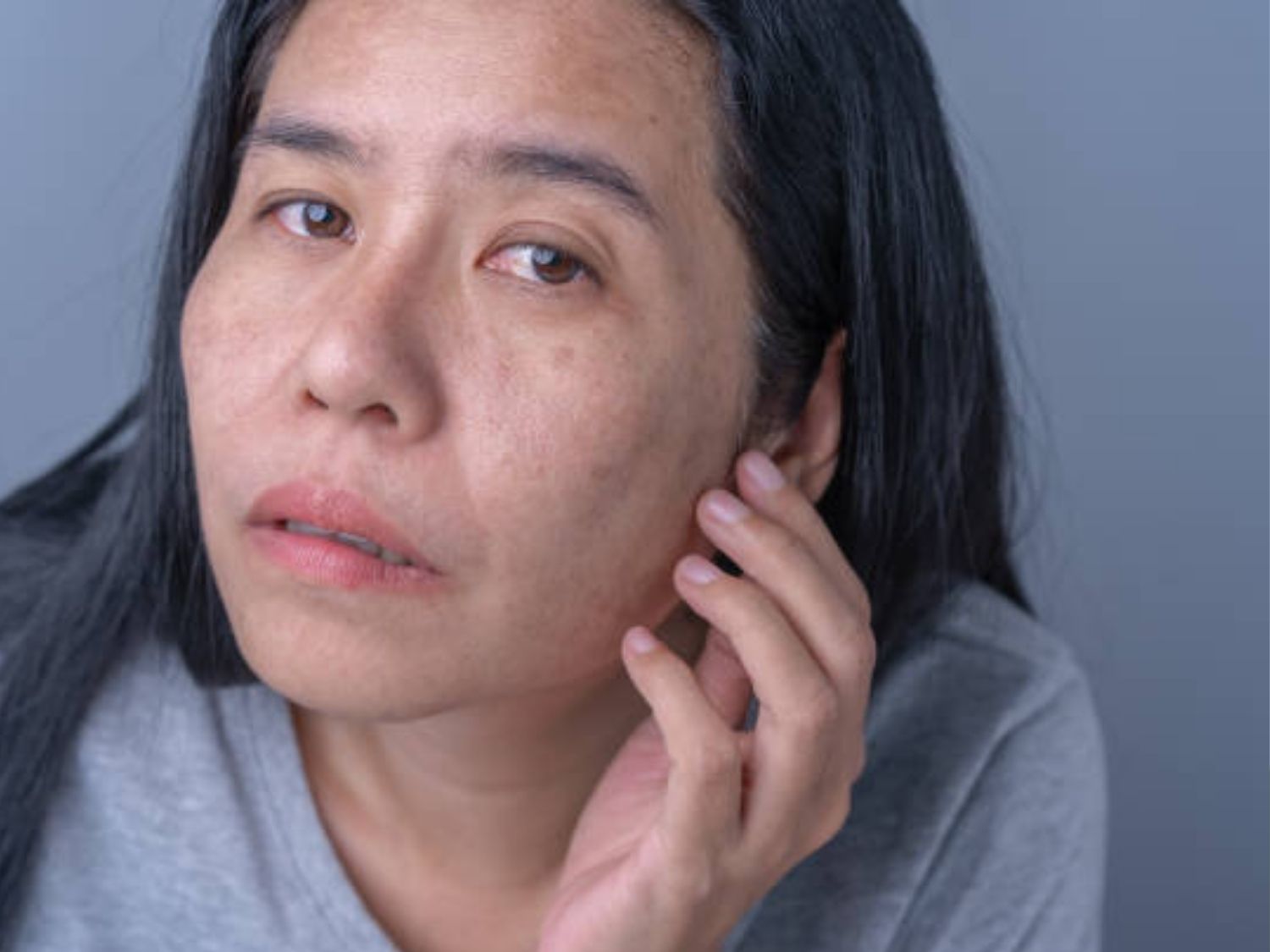 Ngưng mọi liệu trình khi da đang có biểu hiện tổn thương