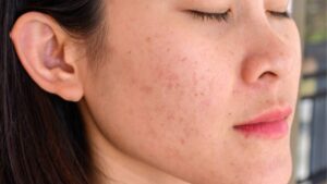 Da hỏng sau liệu trình khám ở đâu? Quy trình tiếp nhận & xử lý