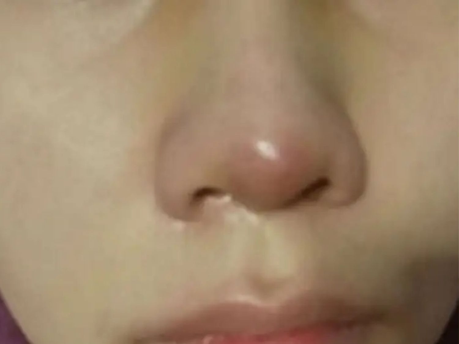 da đầu mũi mỏng và bóng đỏ