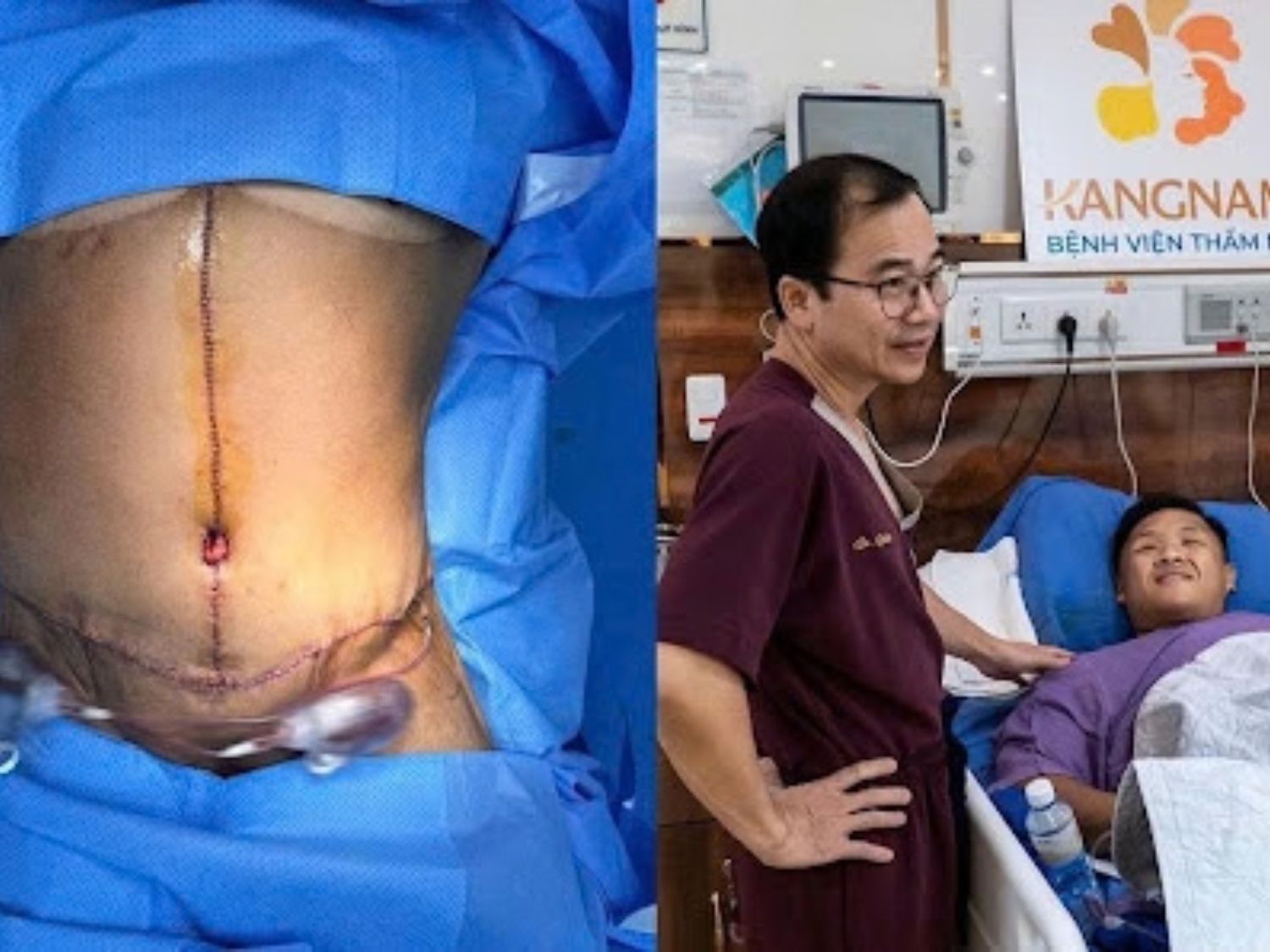 Ca phẫu thuật cắt da lần thứ 3 của Trọng Nhân kéo dài 10 tiếng với kết quả vượt mong đợi