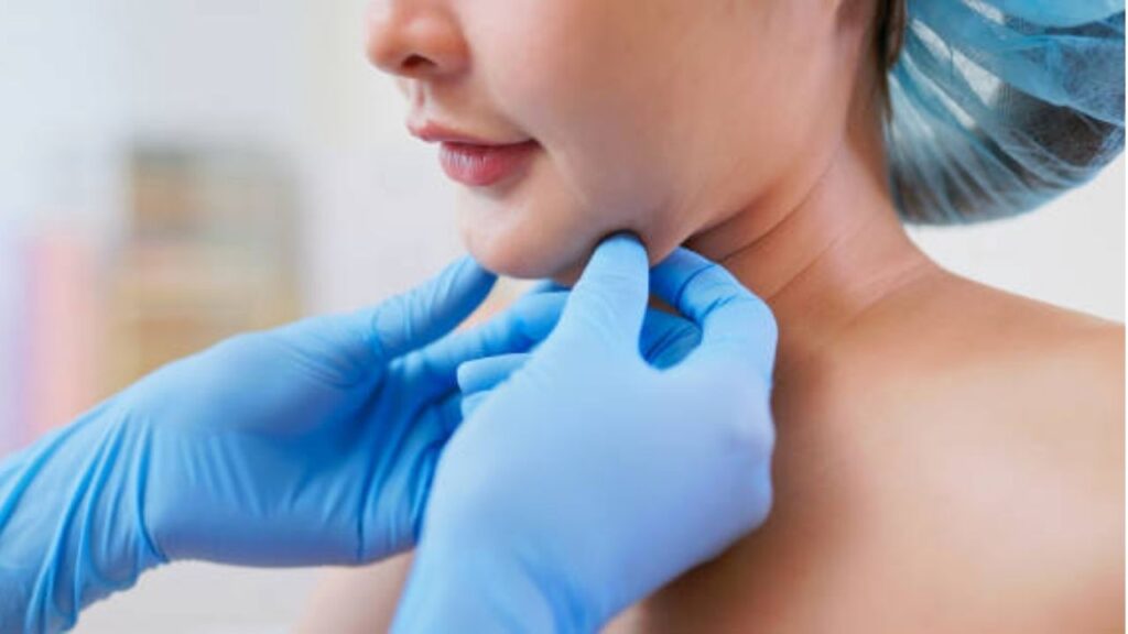 Sau hút mỡ nọng cằm da bị chảy xệ cần làm thế nào?
