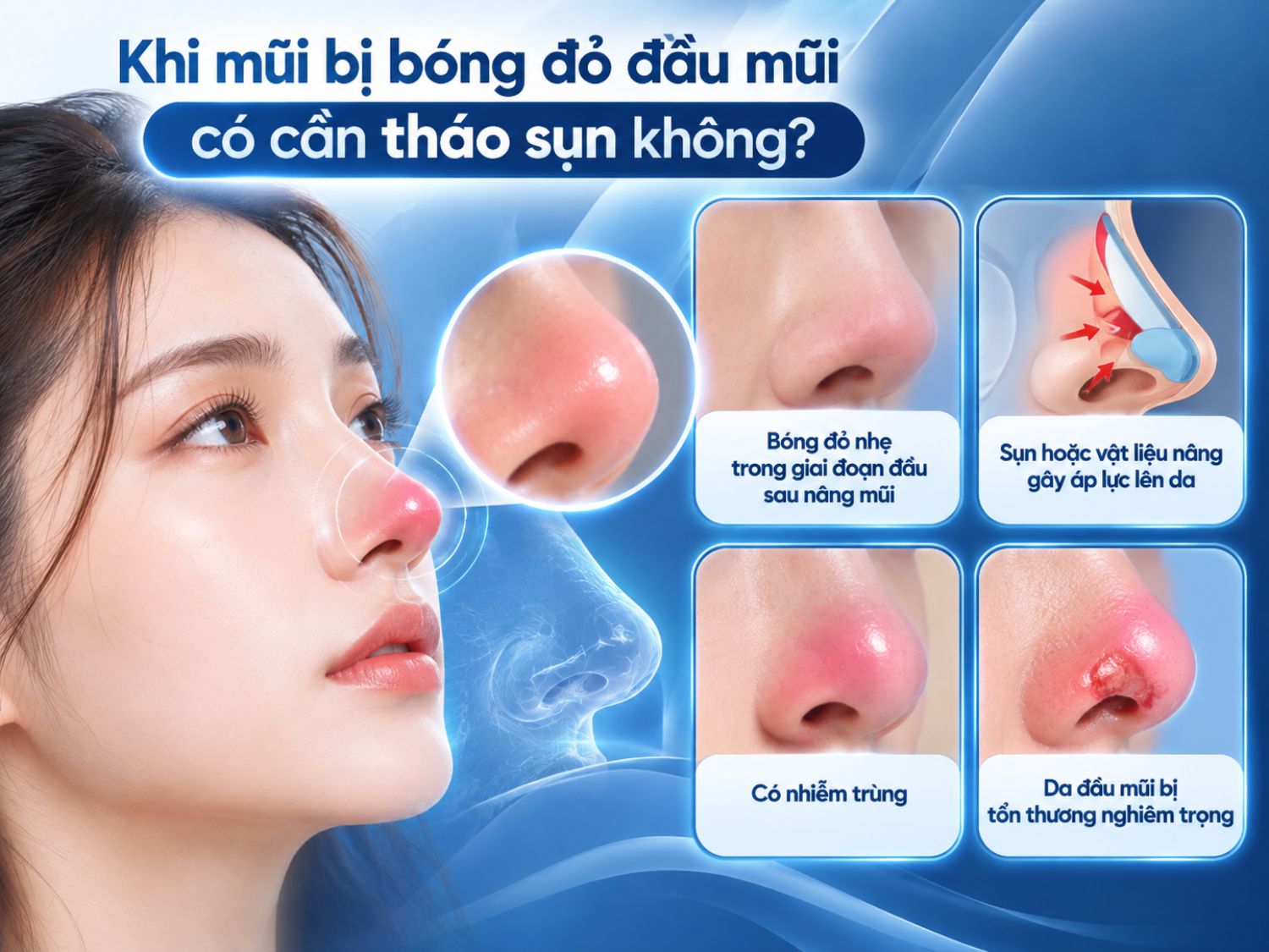 Đầu mũi bóng đỏ sau nâng có thể do nhiều nguyên nhân, từ phản ứng trong giai đoạn hồi phục đến áp lực của vật liệu nâng, nhiễm trùng hoặc tổn thương da; cần được bác sĩ đánh giá trước khi quyết định xử trí.