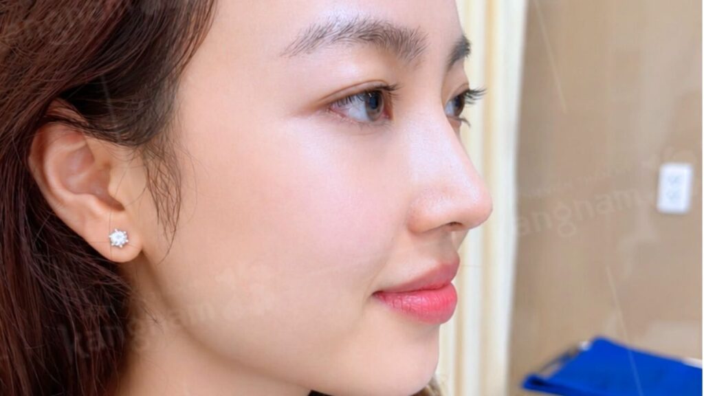 Làm sao phân biệt review thật và review được trả tiền khi tìm nơi nâng mũi?
