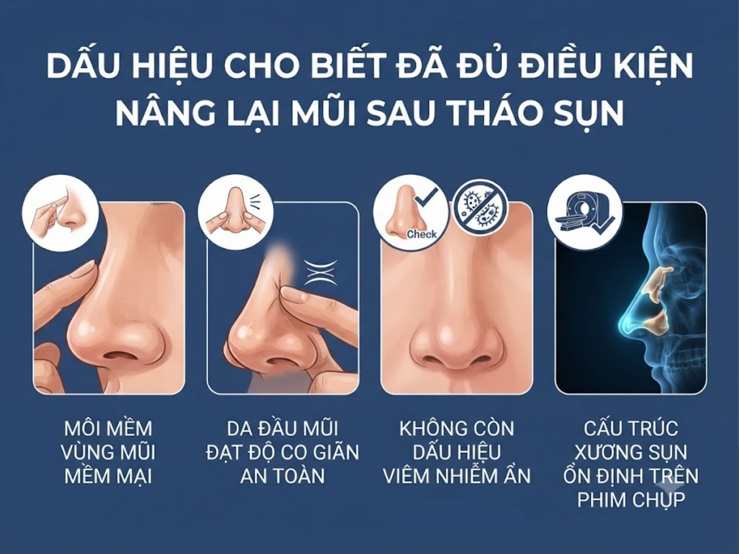 Dấu hiệu cho biết đã đủ điều kiện nâng lại mũi sau tháo sụn
