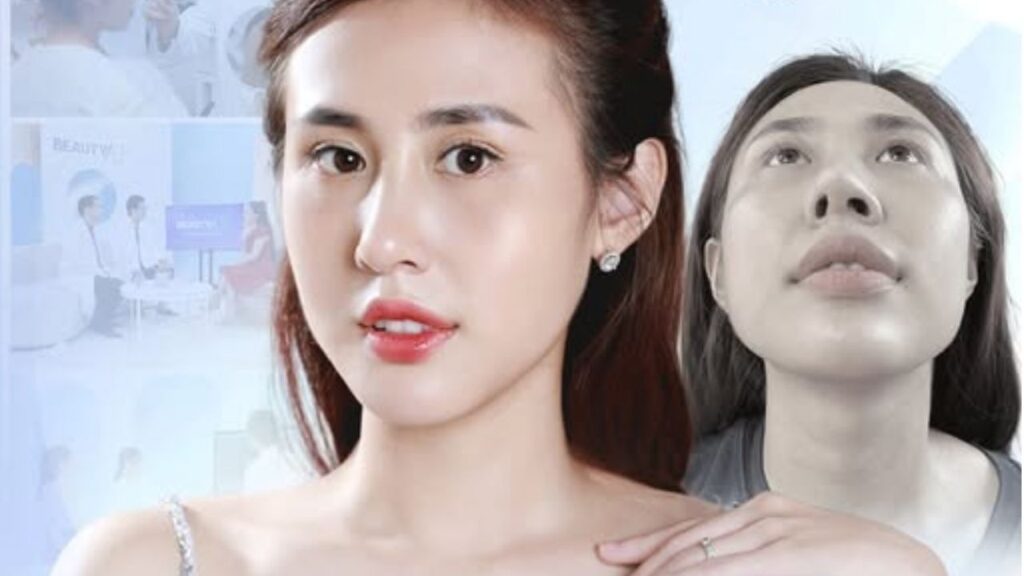Mũi sau nâng bị lệch sang một bên thì sửa lại có khó không?