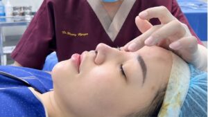 Nâng mũi ở đâu uy tín và an toàn tại Hà Nội?