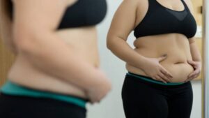 Sinh mổ hút mỡ bụng có an toàn không? Khi nào nên thực hiện