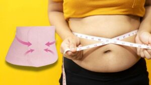 Tách cơ thẳng bụng sau hút mỡ có phải hút mỡ không thành công? Cách xử lý thế nào