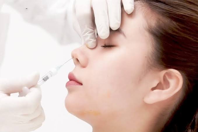 Tiêm thuốc giải filler HA có thể được bác sĩ chỉ định khi nghi ngờ tắc mạch do filler và cần xử trí kịp thời.
