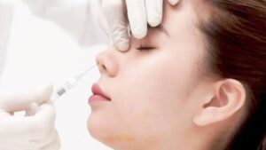 Filler mũi tiêm ở spa bị hoại tử thì cấp cứu ở đâu?