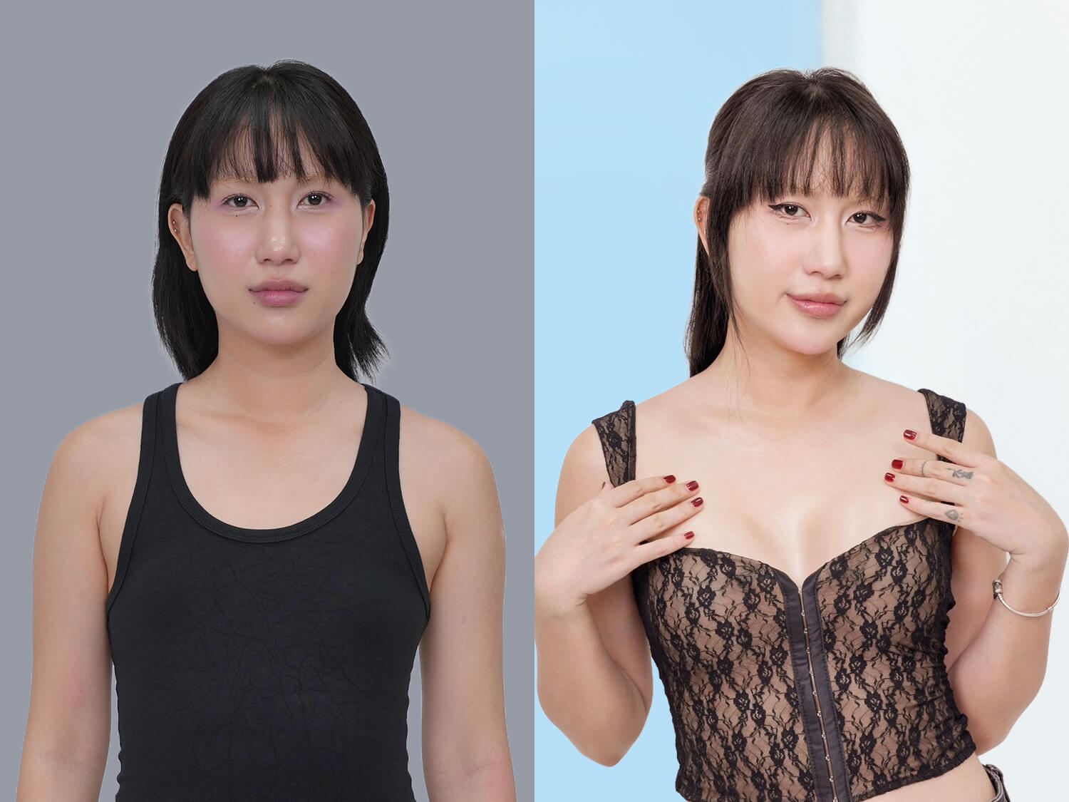 Ca sĩ Pay thực hiện nâng ngực tại Kangnam
