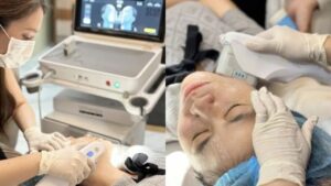 Kangnam có máy Ultherapy PRIME chính hãng không?