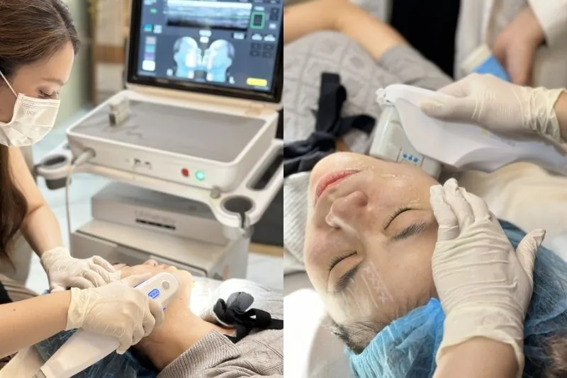 Ultherapy PRIME ứng dụng năng lượng siêu âm hội tụ để tác động vào vùng điều trị, hướng đến cải thiện độ săn chắc và tình trạng da chảy xệ mà không cần phẫu thuật.