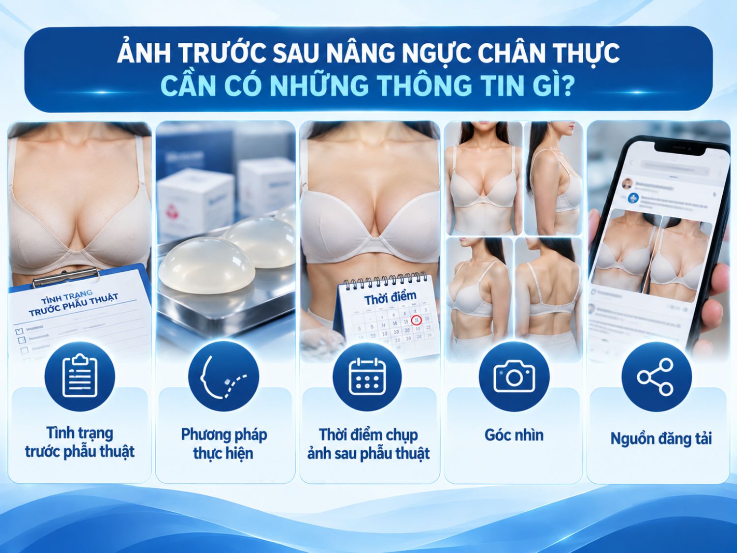 Hình ảnh trước và sau nâng ngực đáng tin cậy cần thể hiện rõ tình trạng ngực ban đầu, phương pháp phẫu thuật, thời điểm ghi nhận kết quả và các góc chụp tương đồng. Khách hàng cũng nên kiểm tra nguồn đăng tải để đánh giá tính xác thực của hình ảnh.