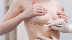Câu hỏi khi tư vấn nâng ngực: 20 điều cần hỏi bác sĩ trước khi phẫu thuật