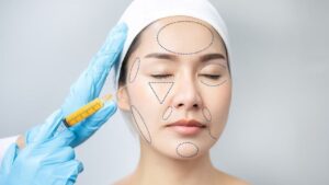 Báo giá cấy mỡ gồm những gì? 6 khoản cần kiểm tra để tránh phát sinh