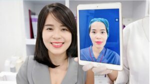 Cấy mỡ mặt ở đâu uy tín Hà Nội? Bác sĩ tư vấn