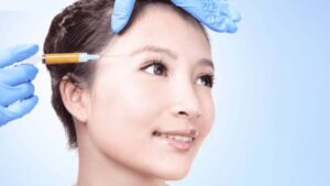 Cấy mỡ thái dương giá bao nhiêu? Bảng giá và các khoản cần biết trước khi thực hiện