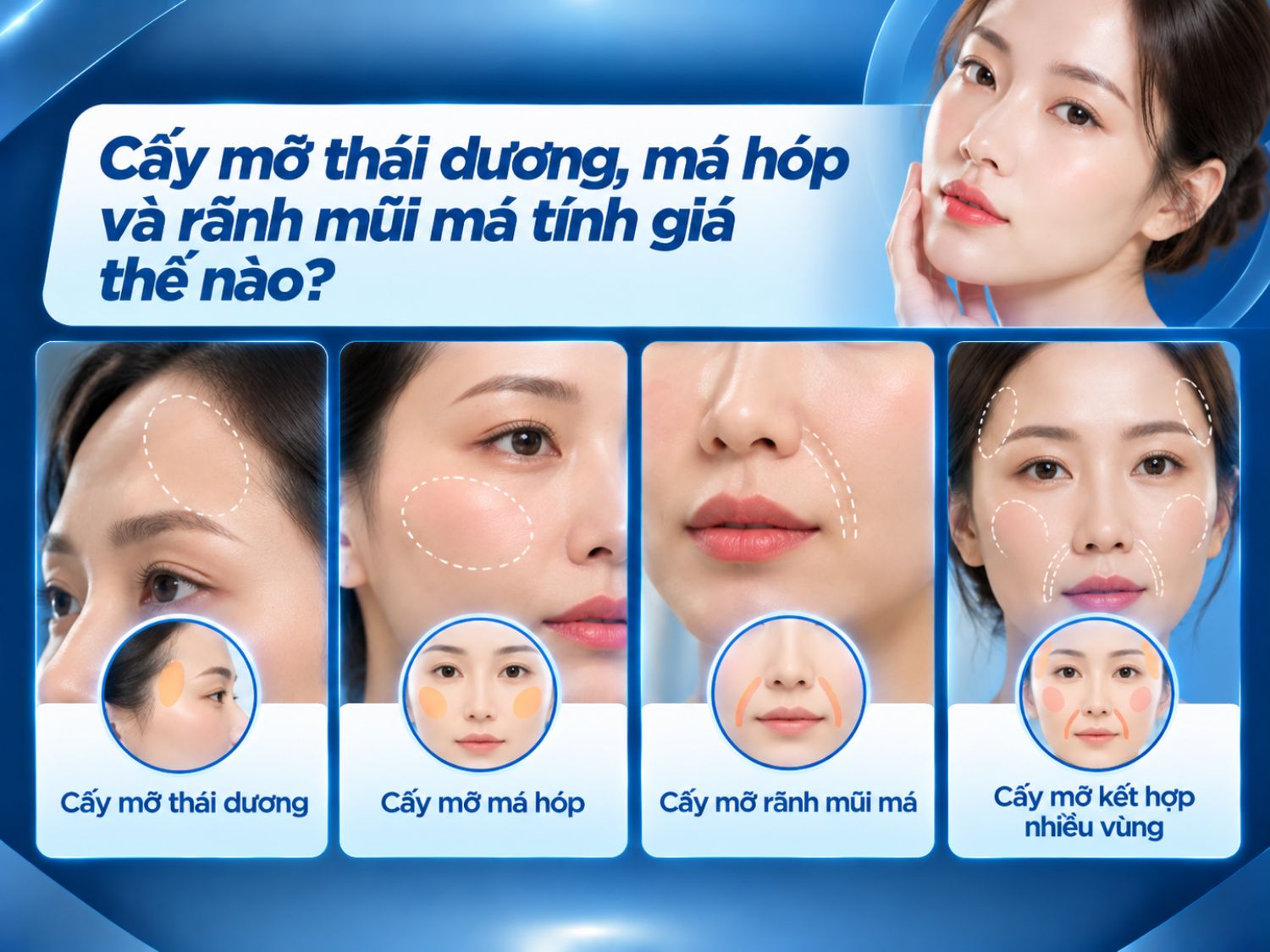Chi phí cấy mỡ thái dương, má hóp và rãnh mũi má có thể khác nhau tùy từng vùng điều trị. Trường hợp cấy mỡ kết hợp nhiều vùng cần được bác sĩ đánh giá để xác định lượng mỡ và chi phí phù hợp.