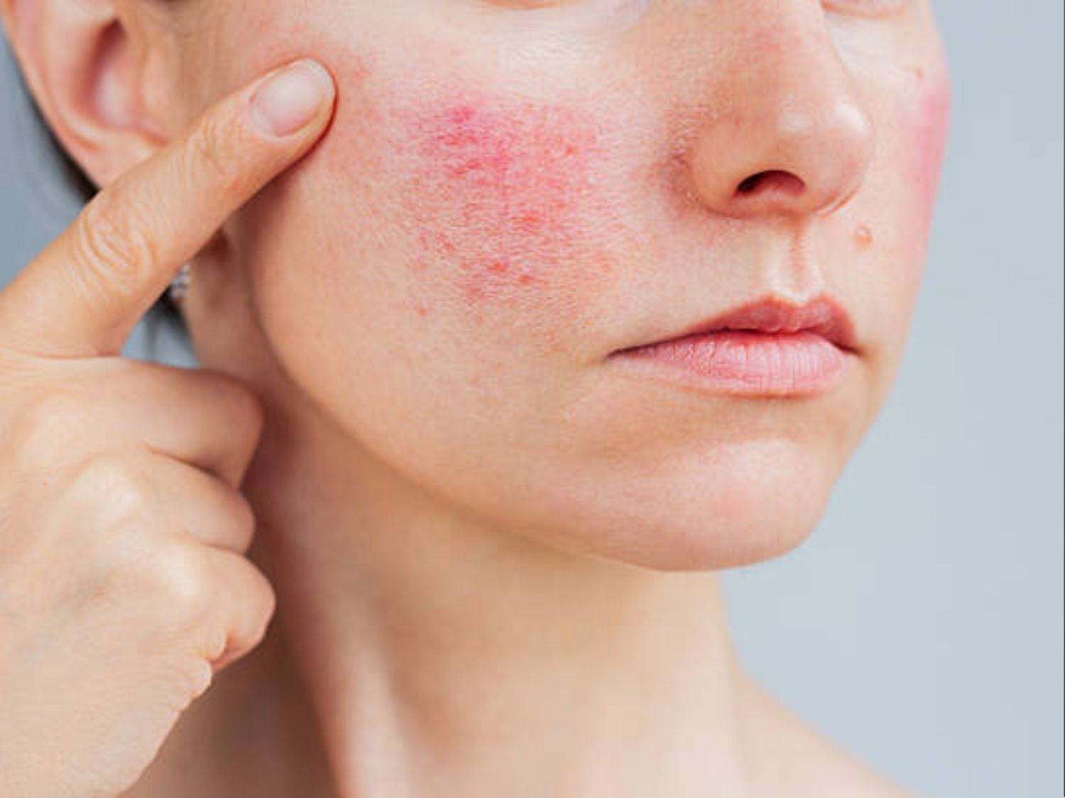 tình trạng da mẩn đỏ, kích ứng thì nên chọn bệnh viện