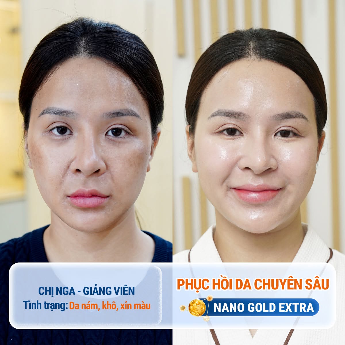 Chăm sóc và cải thiện làn da khô, xin màu với dịch vụ phục hồi chuyên sâu