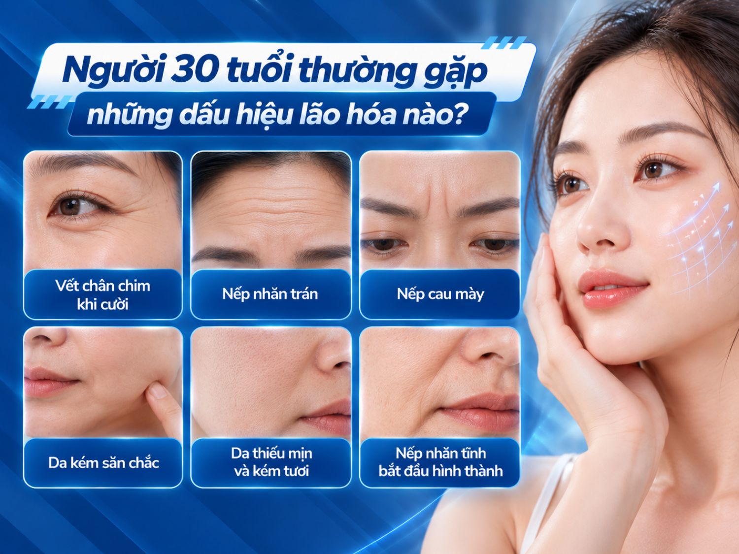 Sau 30 tuổi làn da gặp tình trạng vết chân chim, nếp nhăn trán, nếp cau mày, da kém săn chắc