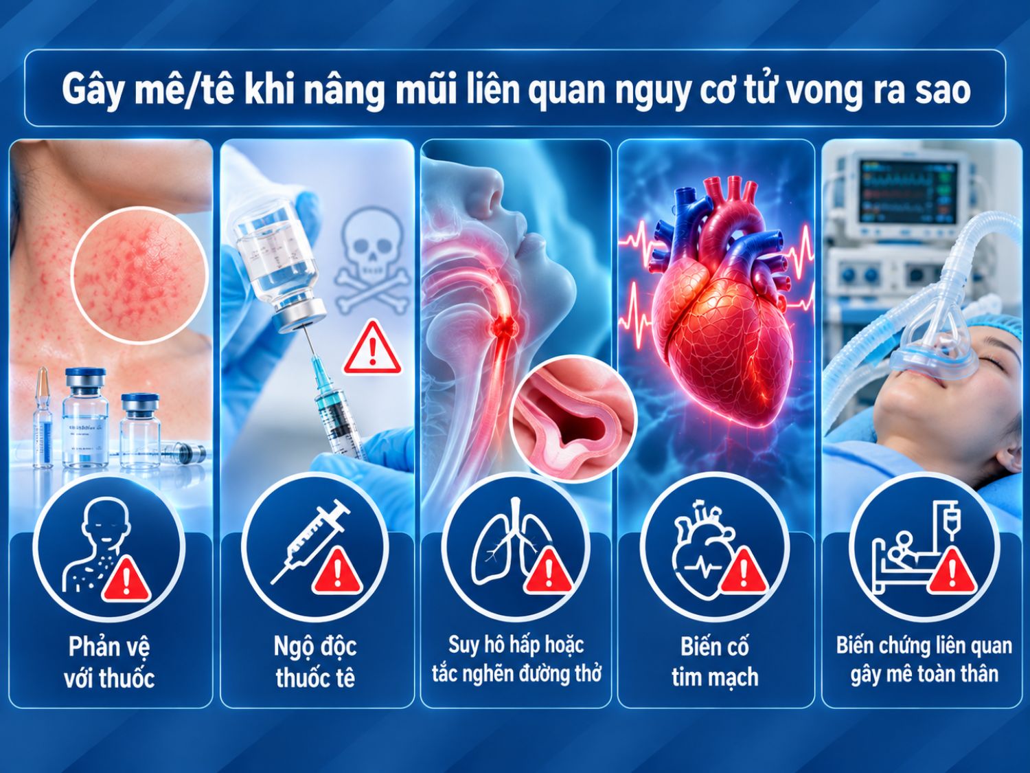 Các biến chứng nghiêm trọng liên quan gây mê – gây tê có thể gồm phản vệ với thuốc, ngộ độc thuốc tê, suy hô hấp, tắc nghẽn đường thở, biến cố tim mạch và biến chứng của gây mê toàn thân.