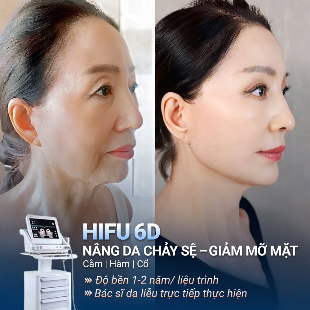 Công nghệ Hifu giúp da săn chắc, giảm chảy xệ và duy trì hiệu quả ổn định