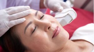 HIFU nâng cơ giá bao nhiêu tiền một lần & Yếu tố ảnh hưởng chi phí