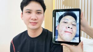 Kangnam chăm sóc da nam: Dịch vụ, công nghệ và bảng giá tham khảo