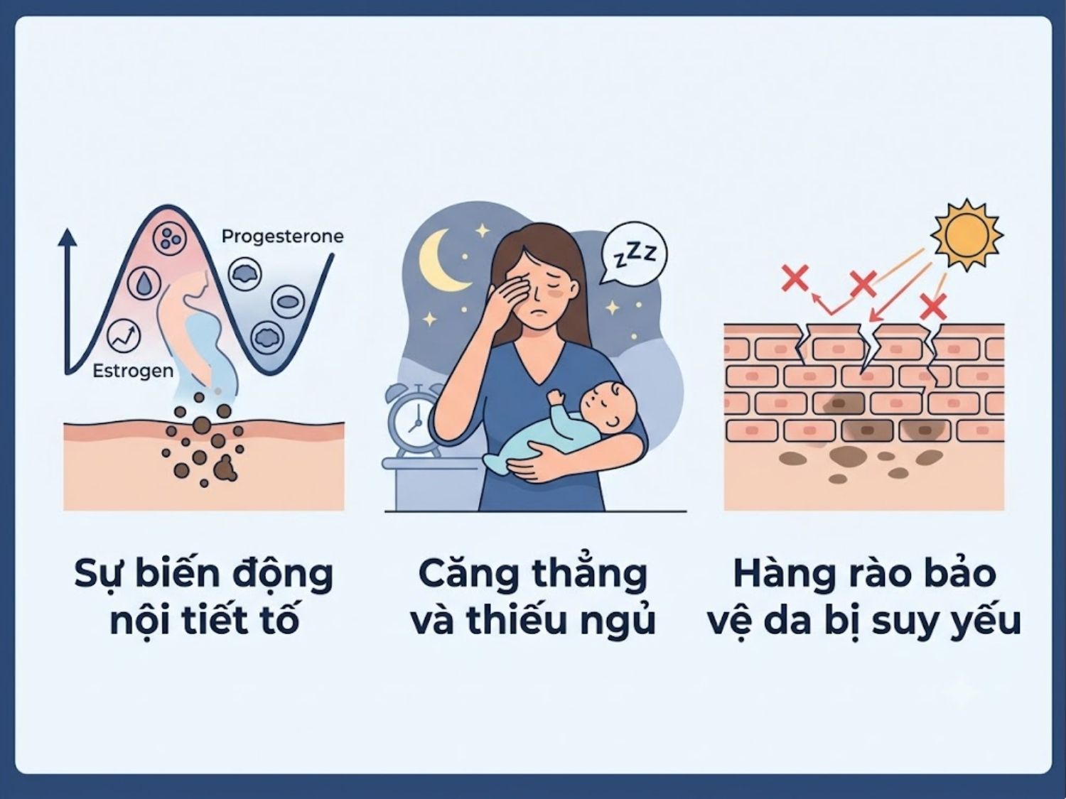 ảnh mô tả Tại sao mẹ sau sinh lại dễ bị nám da và khó điều trị