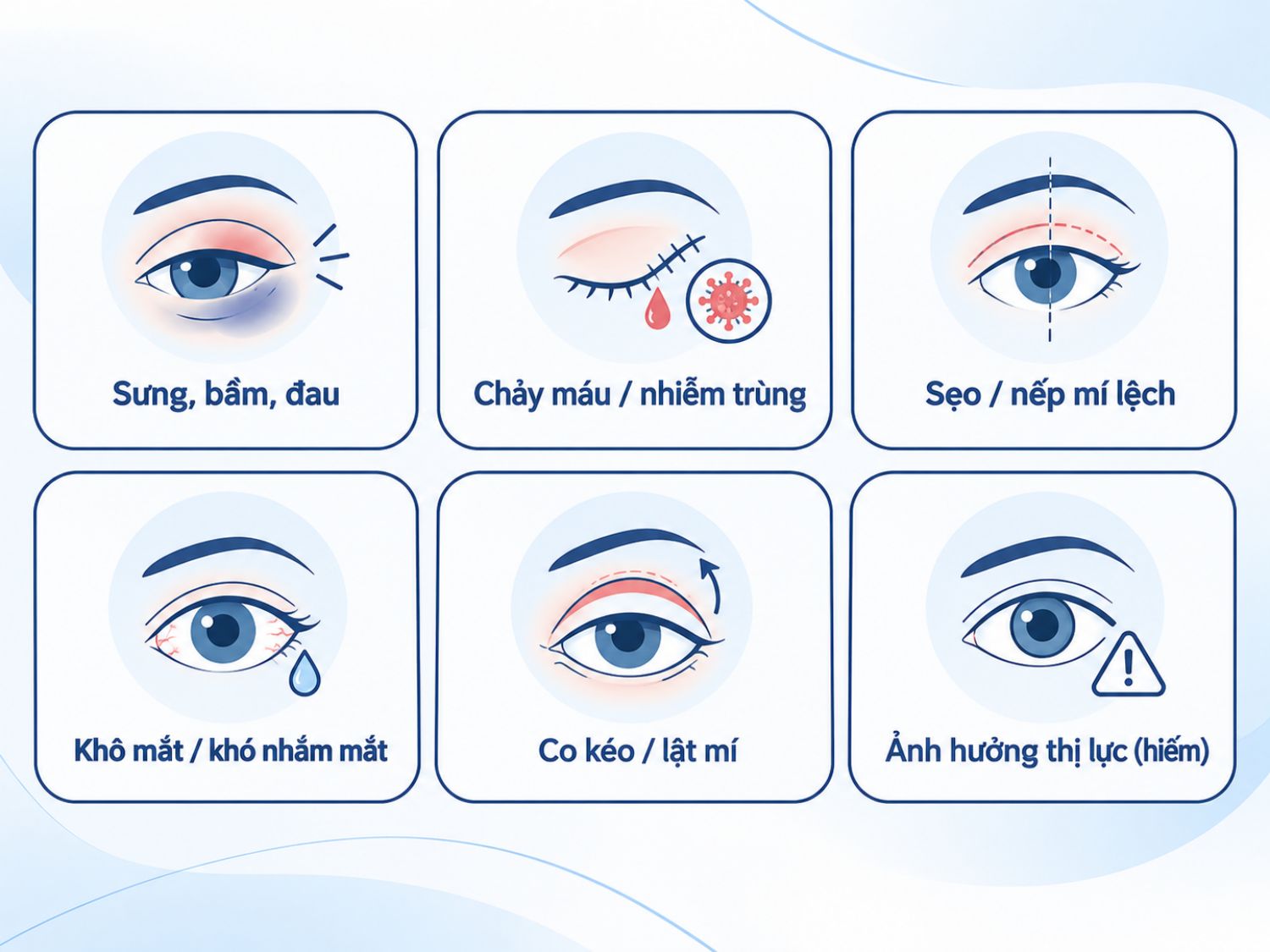 ảnh mô tả Một số rủi ro có thể gặp sau thẩm mỹ mắt gồm